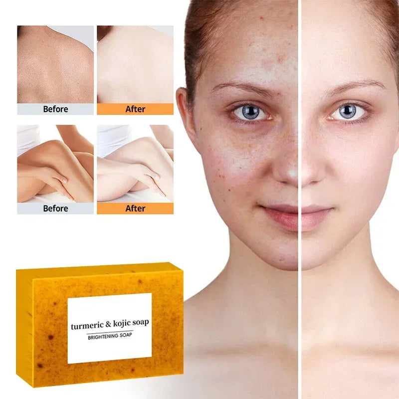 Turmeric Lemon Kojic Exfoliating Soap