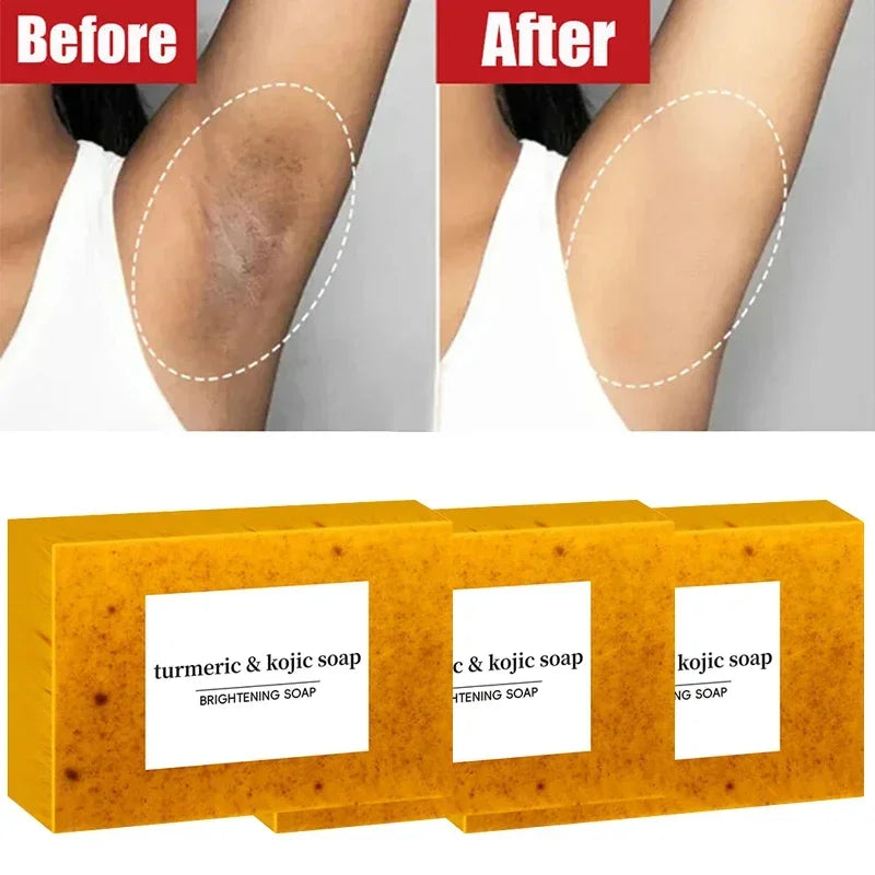 Turmeric Lemon Kojic Exfoliating Soap