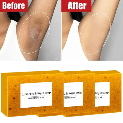 Turmeric Lemon Kojic Exfoliating Soap